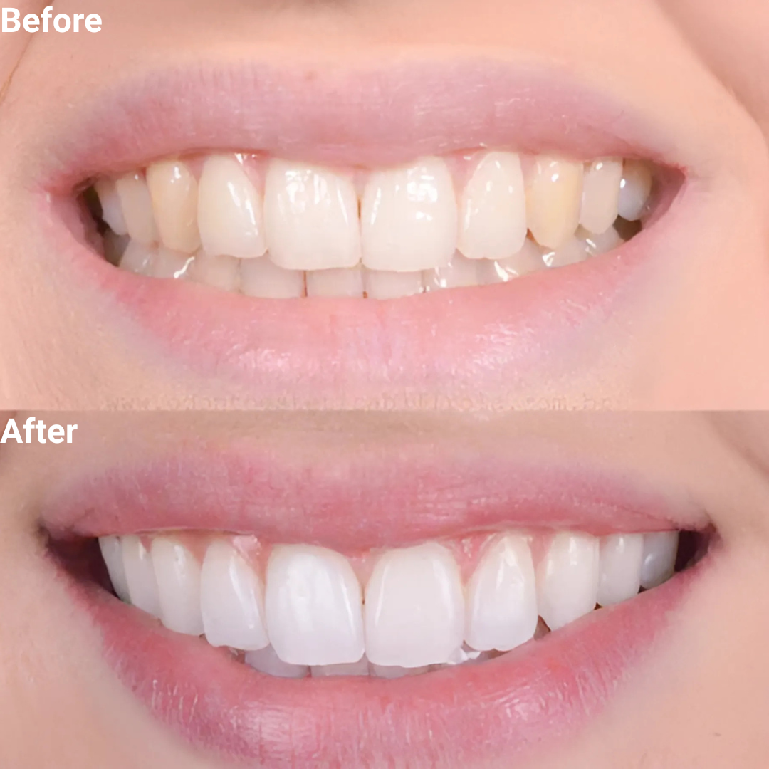 Vytacore Triple Whitening Toothpaste